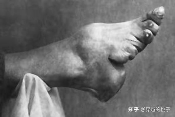小脚为什么称为三寸金莲?小脚女人的三寸金莲?