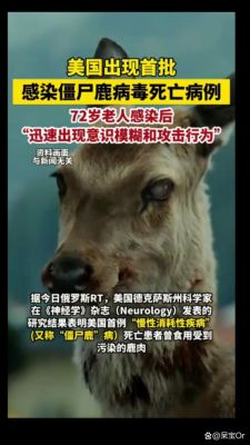 美国真的在研究丧尸病毒,美国有没有研究出丧尸病毒?