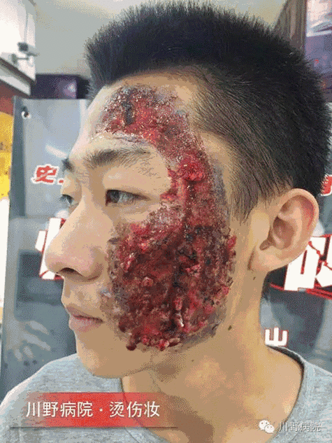 玉米男孩图片吓人原图?玉米男孩密集恐惧症?